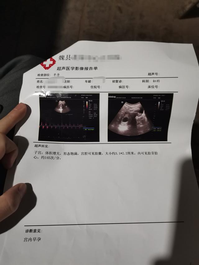 老婆在精神病院怀孕（在精神病院怀孕的女人）