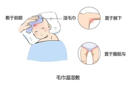 婴儿物理退烧的正确方法(正确给幼儿退烧的技巧)